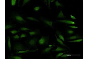 Immunofluorescence of purified MaxPab antibody to RPS6KB2 on HeLa cell. (RPS6KB2 antibody  (AA 1-482))