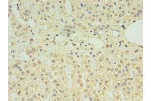 Immunohistochemistry of paraffin-embedded human adrenal gland tissue using ABIN7146897 at dilution of 1:100 (CLPB antibody  (AA 1-350))
