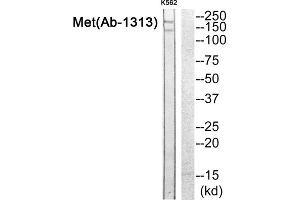 Western blot analysis of extracts from K562 cells, using Met (epitope around residue 1313) antibody. (c-MET antibody)