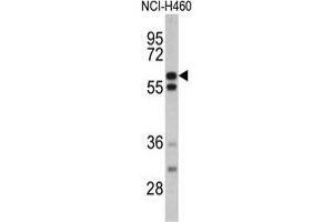 Western blot analysis of GNS antibody (Center S298) in NCI-H460 cell line lysates (35 µg/lane). (GNS antibody  (Middle Region))