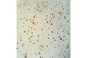 Immunohistochemistry analysis in formalin fixed and paraffin embedded human brain tissue reacted with MED25 Antibody (N-term) followed which was peroxidase conjugated to the secondary antibody and followed by DAB staining. (MED25 antibody  (N-Term))