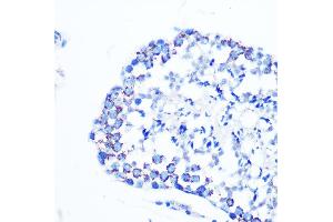 Immunohistochemistry of paraffin-embedded mouse testis using Monoamine Oxidase B (MAOB) (MAOB) Rabbit mAb (ABIN7268682) at dilution of 1:100 (40x lens). (Monoamine Oxidase B antibody)