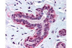 Anti-WRNIP1 / WHIP antibody IHC of human breast. (WRNIP1 antibody  (AA 67-116))