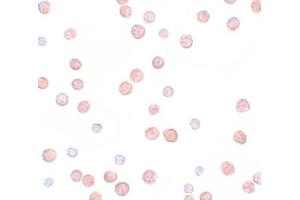 Immunohistochemistry (IHC) image for anti-Pappalysin 2 (PAPPA2) (N-Term) antibody (ABIN1031518) (PAPPA2 antibody  (N-Term))