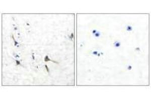 Immunohistochemical analysis of paraffin-embedded human brain tissue using Potassium Channel Kv3. (KCNC2 antibody)