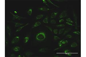 Immunofluorescence of purified MaxPab antibody to GSTK1 on HeLa cell. (GSTK1 antibody  (AA 1-226))