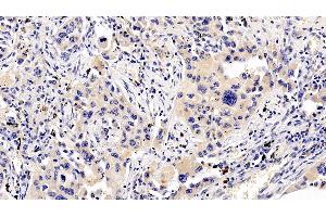 Immunohistochemistry (IHC) image for anti-Ribosomal Protein S6 Kinase, 70kDa, Polypeptide 1 (RPS6KB1) (AA 91-352) antibody (ABIN7430135)