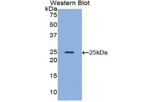 Western Blotting (WB) image for anti-Alcohol Dehydrogenase 1 (Class I) (ADH1) (AA 25-228) antibody (ABIN1857916) (ADH1 antibody  (AA 25-228))