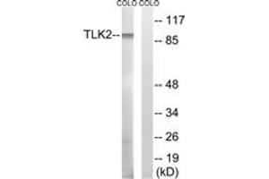 Western blot analysis of extracts from COLO cells, using TLK2 Antibody. (TLK2 antibody  (AA 191-240))