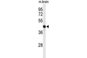Western Blotting (WB) image for anti-1-Acylglycerol-3-Phosphate O-Acyltransferase 6 (Lysophosphatidic Acid Acyltransferase, Zeta) (AGPAT6) (AA 52-82), (N-Term) antibody (ABIN950303)