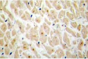 Immunohistochemistry (IHC) analyzes of MAPKAPK-2 antibody in paraffin-embedded human heart tissue. (MAPKAP Kinase 2 antibody)
