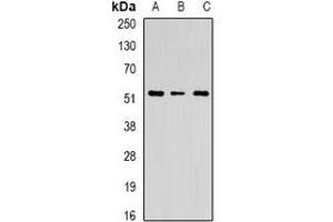 Western blot analysis of Chitotriosidase expression in U251 (A), HEK293T (B), mouse spleen (C) whole cell lysates.
