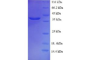 SDS-PAGE (SDS) image for Mucin 2, Oligomeric Mucus/gel-Forming (MUC2) (AA 36-240) protein (His-SUMO Tag) (ABIN4975618)