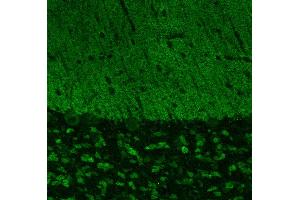Indirect immunostaining of PFA fixed cerebellum sections (dilution 1 : 500). (SHANK3 antibody  (AA 1055-1616))