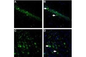 Expression of NLGN1 in rat hippocampus and cortex - Immunohistochemical staining of free floating frozen section of rat hippocampal CA1 region (A, B) and rat parietal cortex (C, D) using Anti-Neuroligin 1 (extracellular) Antibody (ABIN7043361, ABIN7044680 and ABIN7044681), (1:300). (Neuroligin 1 antibody  (Extracellular, N-Term))