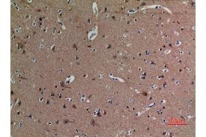 Immunohistochemistry (IHC) image for anti-alpha Tubulin (TUBA1) (acLys40) antibody (ABIN3181895)