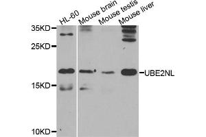 Western blot analysis of extracts of various cell lines, using UBE2NL antibody. (UBE2NL antibody)