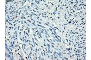Image no. 5 for anti-Fc Fragment of IgG, Low Affinity IIa, Receptor (CD32) (FCGR2A) antibody (ABIN1497259)