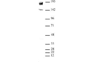 PBRM1 (pAb) tested by Western blot. (Polybromo 1 antibody  (N-Term))