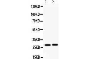 Western Blotting (WB) image for anti-Insulin-Like Growth Factor Binding Protein 1 (IGFBPI) (AA 177-207), (C-Term) antibody (ABIN3042732)