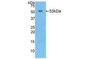 Western blot analysis of recombinant Human KLK6.