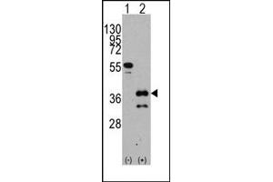 Image no. 1 for anti-Zic Family Member 4 (ZIC4) (C-Term) antibody (ABIN357859) (ZIC4 antibody  (C-Term))