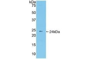 Detection of Recombinant PCDHb2, Mouse using Polyclonal Antibody to Protocadherin Beta 2 (PCDHb2) (PCDHb2 antibody  (AA 79-253))