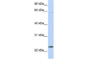 CHAC1 antibody used at 1 ug/ml to detect target protein. (CHAC1 antibody)