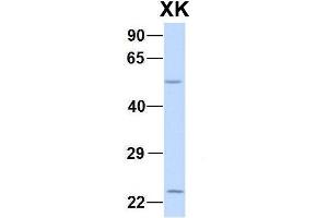 Host:  Rabbit  Target Name:  CHAD  Sample Type:  Human Adult Placenta  Antibody Dilution:  1. (Membrane transport protein XK (XK) (N-Term) antibody)
