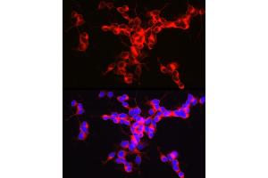 Immunofluorescence analysis of SH-SY5Y cells using ENPP5 Rabbit mAb (ABIN7266899) at dilution of 1:100 (40x lens). (ENPP5 antibody)