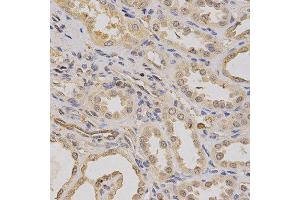 Immunohistochemistry of paraffin-embedded human kidney using ATP6AP1 antibody at dilution of 1:200 (x400 lens). (ATP6AP1 antibody)