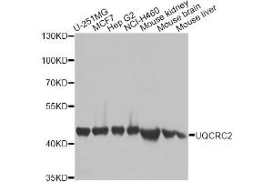 Western blot analysis of extracts of various cell lines, using UQCRC2 antibody. (UQCRC2 antibody)