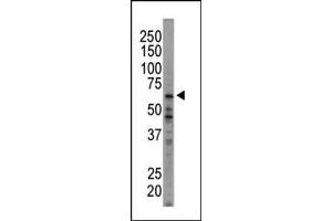 Western Blotting (WB) image for anti-Eukaryotic Translation Initiation Factor 2-alpha Kinase 1 (EIF2AK1) (AA 1-30), (N-Term) antibody (ABIN392638)