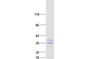 Validation with Western Blot (HAGH Protein (Transcript Variant 1) (Myc-DYKDDDDK Tag))