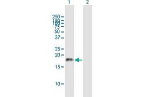 Western Blot analysis of CSF2 expression in transfected 293T cell line by CSF2 MaxPab polyclonal antibody. (GM-CSF antibody  (AA 1-144))