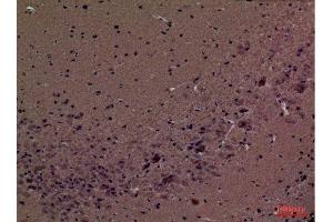 Immunohistochemistry (IHC) image for anti-Peptidylprolyl Isomerase A (Cyclophilin A) (PPIA) (Internal Region) antibody (ABIN6284334)