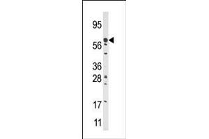 Image no. 1 for anti-Carnitine Palmitoyltransferase 2 (CPT2) (N-Term) antibody (ABIN357770)