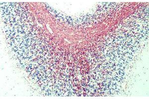 Anti-Myelin Basic Protein antibody IHC of human myelin.
