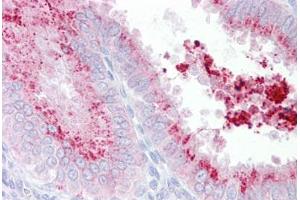 Anti-KIAA1324 antibody IHC staining of human uterus. (ELAPOR1 antibody  (C-Term))