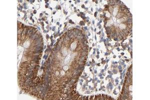 Cytochrome c Antibody for IHC in human colorectal tissue (Cytochrome C antibody)