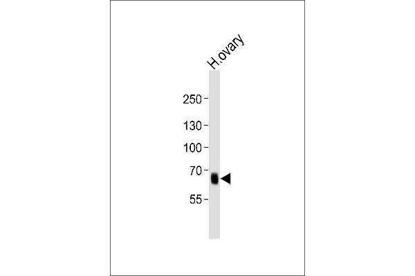 PRDM13 antibody  (N-Term)