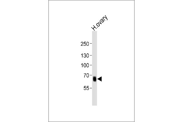 PRDM13 anticorps  (N-Term)