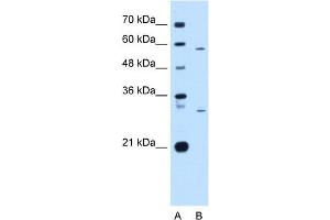 Western Blot showing CD36 antibody used at a concentration of 1-2 ug/ml to detect its target protein. (CD36 antibody)