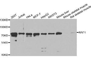 Western Blotting (WB) image for anti-V-Raf-1 Murine Leukemia Viral Oncogene Homolog 1 (RAF1) (AA 190-350) antibody (ABIN3020713) (RAF1 antibody  (AA 190-350))