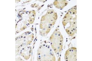 Immunohistochemistry of paraffin-embedded human stomach using HNRNPL antibody. (HNRNPL antibody  (AA 282-589))