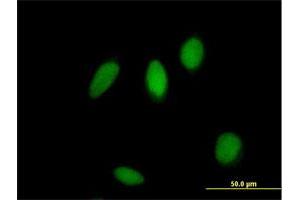 Immunofluorescence of purified MaxPab antibody to ZNF83 on HeLa cell.