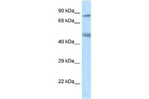 WB Suggested Anti-Zfp90 Antibody   Titration: 1. (ZNF90 antibody  (N-Term))