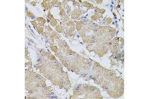 Immunohistochemistry of paraffin-embedded human stomach using BEST1 antibody (ABIN6003520) at dilution of 1/100 (40x lens). (Bestrophin 1 antibody)