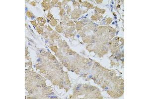Immunohistochemistry of paraffin-embedded human stomach using BEST1 antibody (ABIN6003520) at dilution of 1/100 (40x lens). (Bestrophin 1 antibody)