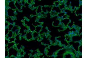 Paraformaldehyde-fixed, paraffin embedded (Mouse lung), Antigen retrieval by boiling in sodium citrate buffer (pH6. (CD8 antibody  (AA 51-150) (Alexa Fluor 488))